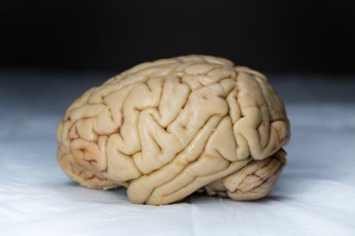 A brain against a black and white backdrop
